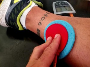 arp wave therapy for plantar fasciitis