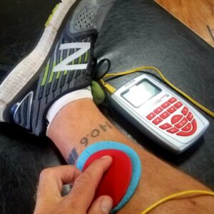 CRPS Complex regional pain syndrome Phoenix waveform ARPwave Therastim