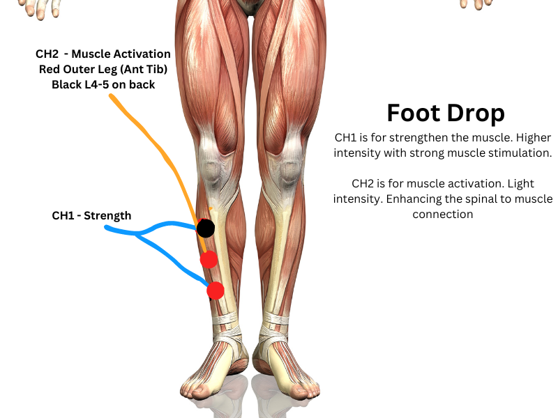 Phoenix Waveform Foot Drop, Neubie, ARPwave